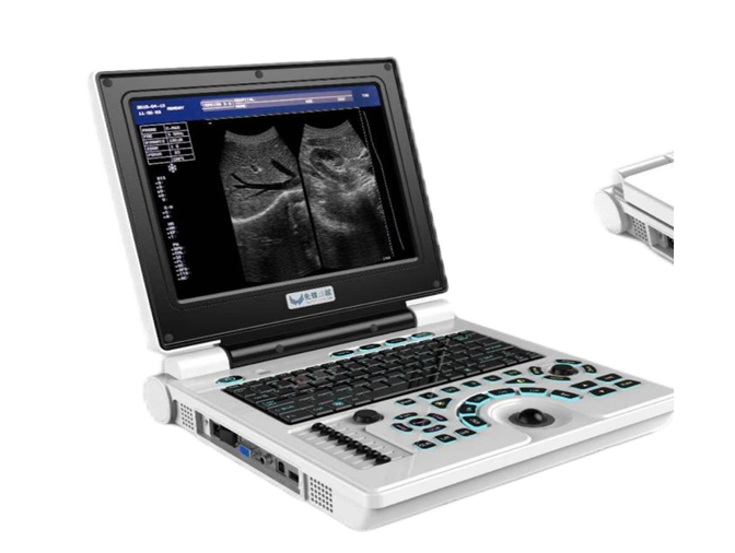 Notebook B/W Ultrasound US-B30B