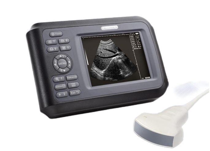 Ultrasound Scanner US-B20A