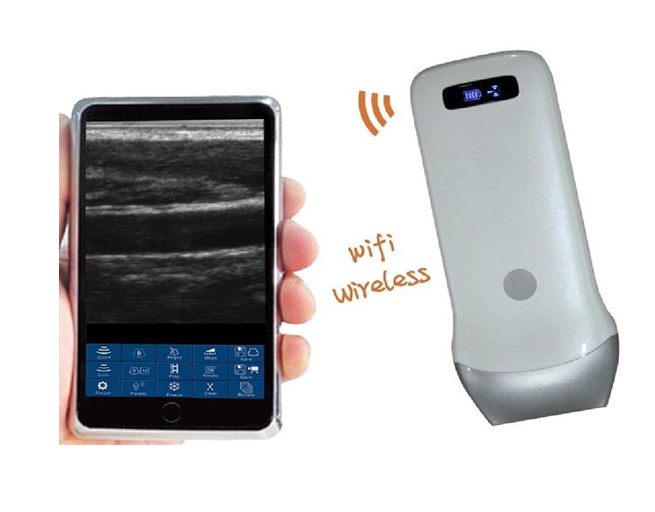 Wireless Probe Type UItrasound Scanner US-3L